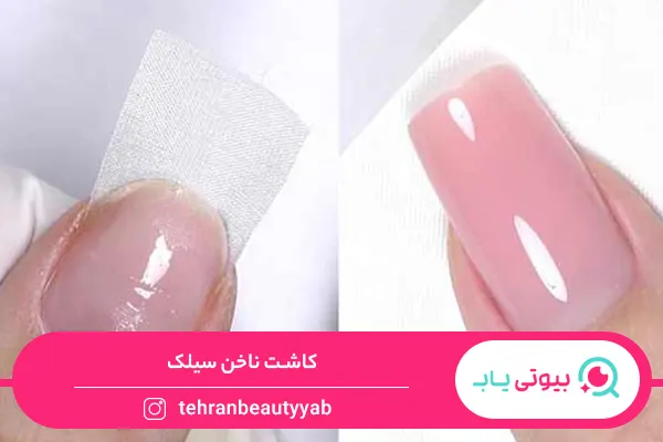 انواع کاشت ناخن