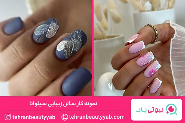 معرفی-بهترین-مرکز-کاشت-ناخن-در-شمال-تهران