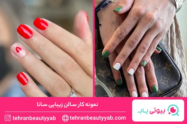معرفی-بهترین-مرکز-کاشت-ناخن-در-شمال-تهران