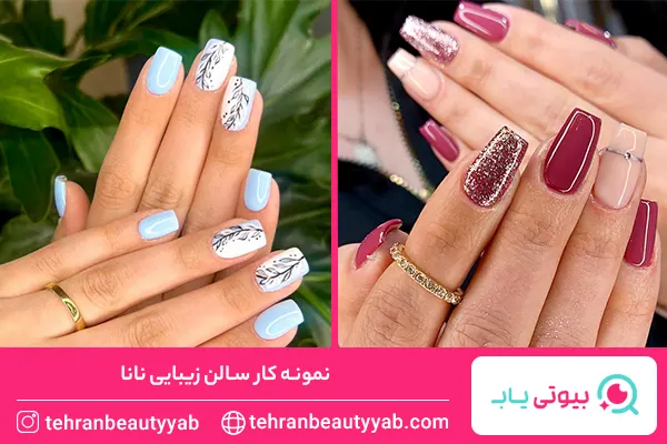 معرفی-بهترین-مرکز-کاشت-ناخن-در-شمال-تهران