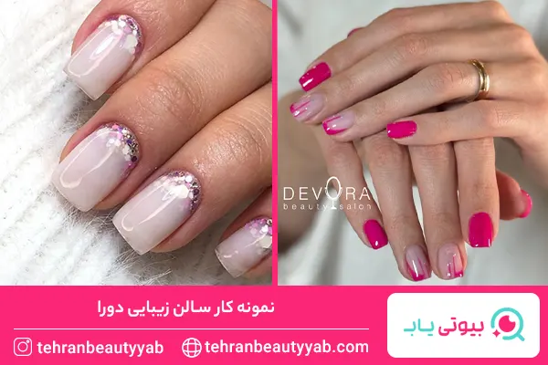 معرفی-بهترین-مرکز-کاشت-ناخن-در-شمال-تهران