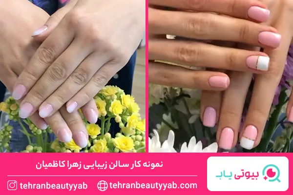 معرفی-بهترین-مرکز-کاشت-ناخن-در-شمال-تهران