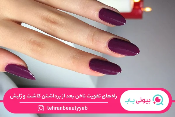 راه های تقویت ناخن بعد از برداشتن کاشت