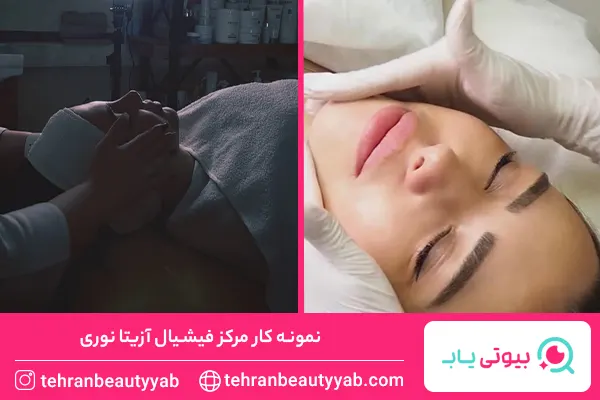 بهترین مرکز فیشیال پوست در تهران