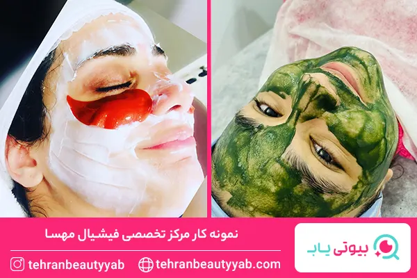 بهترین مرکز فیشیال پوست در تهران