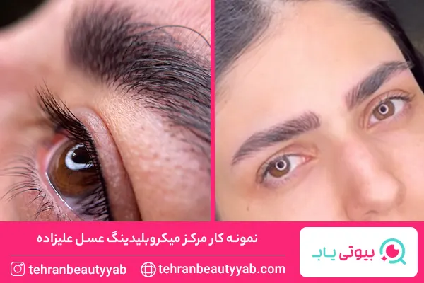 بهترین مرکز میکروبلیدینگ در تهران