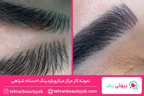 بهترین مرکز میکروبلیدینگ در تهران