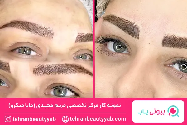 بهترین مرکز میکروبلیدینگ در تهران