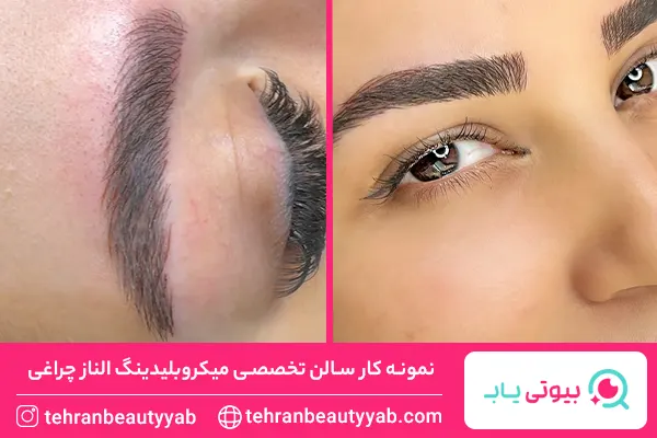 بهترین مرکز میکروبلیدینگ در تهران