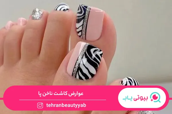 عوارض کاشت ناخن