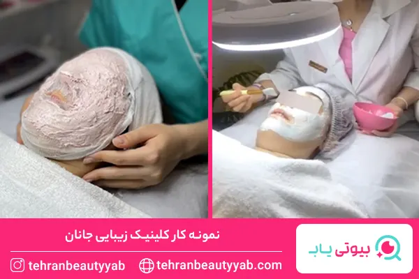 مرکز فیشیال پوست در غرب تهران