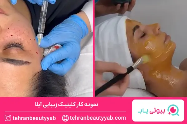 مرکز فیشیال پوست در غرب تهران