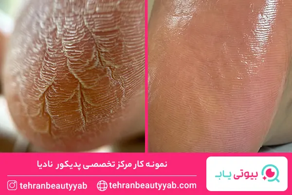 مرکز پدیکور در تهران