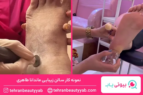 مرکز پدیکور غرب تهران