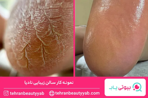 مرکز پدیکور غرب تهران