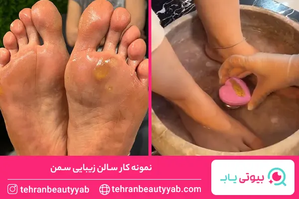 مرکز پدیکور غرب تهران