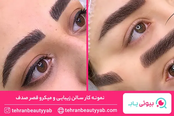 بهترین مرکز میکروبلیدینگ در جنوب تهران