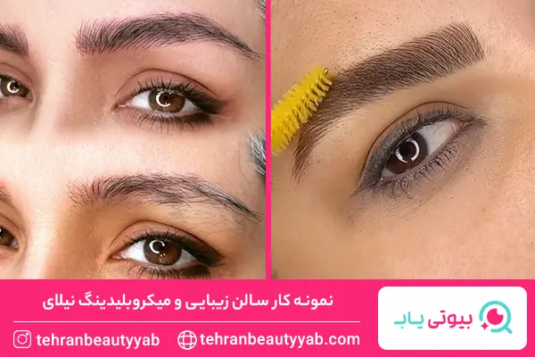 بهترین مرکز میکروبلیدینگ در جنوب تهران