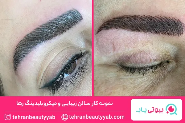 بهترین مرکز میکروبلیدینگ در جنوب تهران