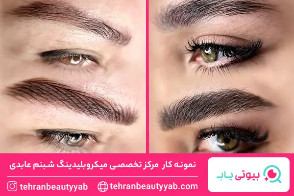 بهترین مرکز میکروبلیدینگ در جنوب تهران