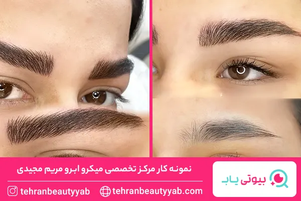 بهترین مرکز میکروبلیدینگ در شرق تهران