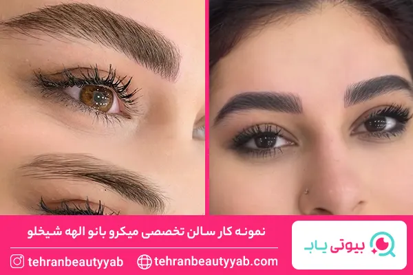 مرکز میکروبلیدینگ در غرب تهران