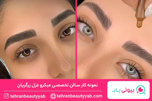 مرکز میکروبلیدینگ در غرب تهران