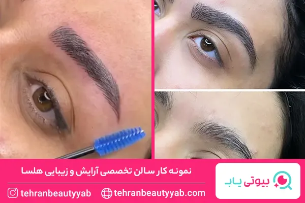 مرکز میکروبلیدینگ در غرب تهران