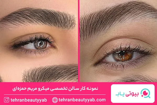 مرکز میکروبلیدینگ در غرب تهران