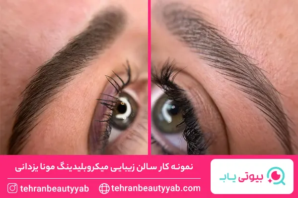 مرکز میکروبلیدینگ در غرب تهران