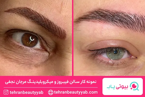 مرکز میکروبلیدینگ در غرب تهران