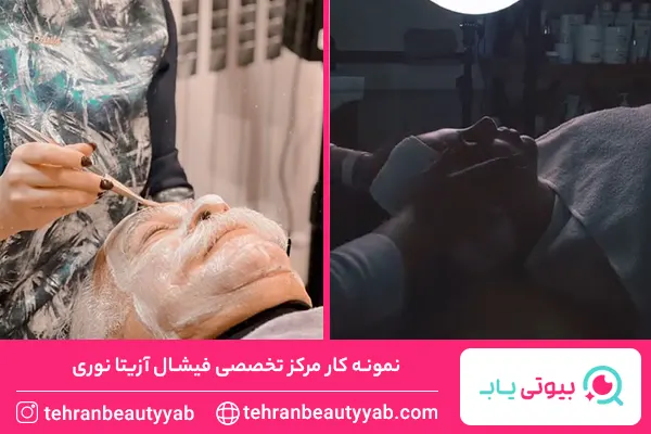 مرکز پاکسازی پوست در شرق تهران