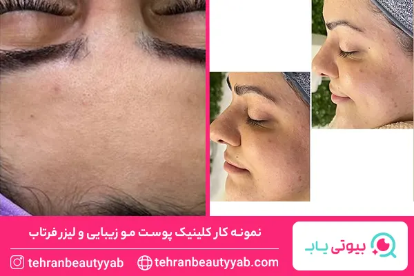 مرکز پاکسازی پوست در شرق تهران