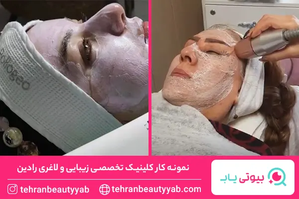 مرکز پاکسازی پوست در شرق تهران
