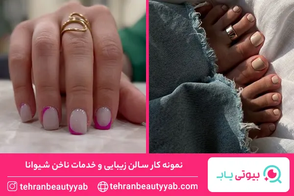 مرکز کاشت ناخن در شهرک غرب