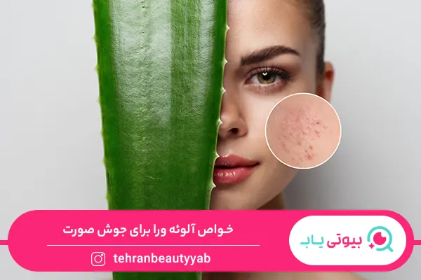 خواص آلوئه ورا برای جوش صورت