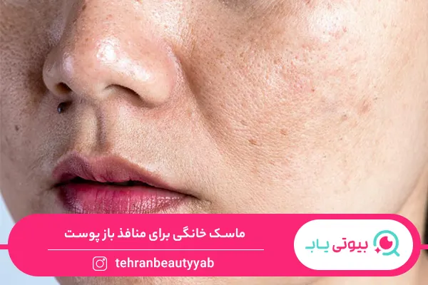 ماسک خانگی برای منافذ باز پوست