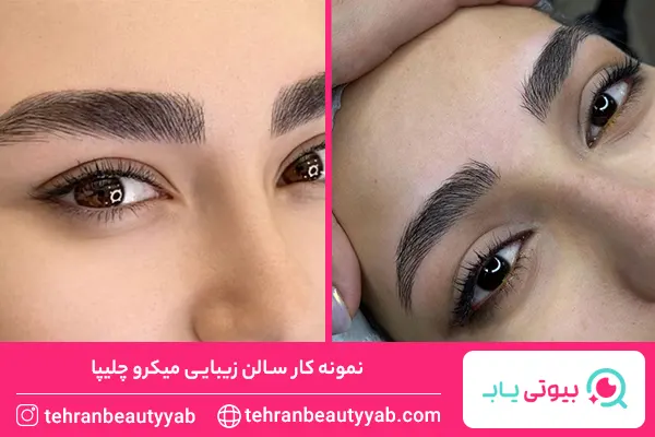 بهترین میکروبلیدینگ کار در تهرانپارس