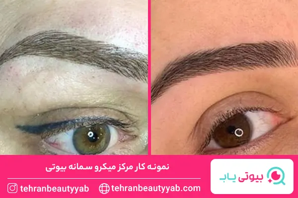 بهترین میکروبلیدینگ کار در تهرانپارس