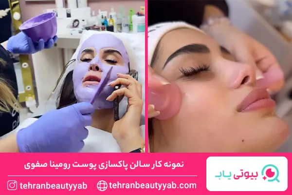 پاکسازی و فیشیال در شمال تهران