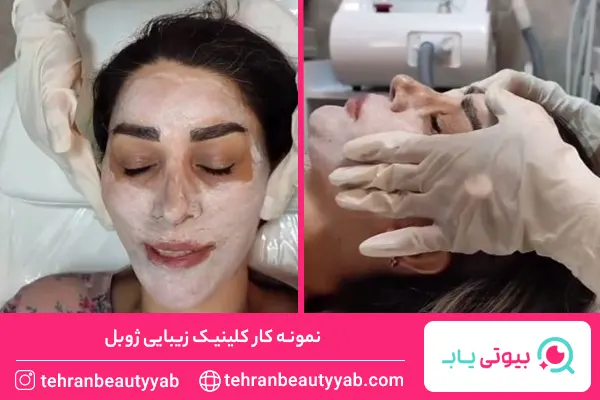 پاکسازی و فیشیال در شمال تهران