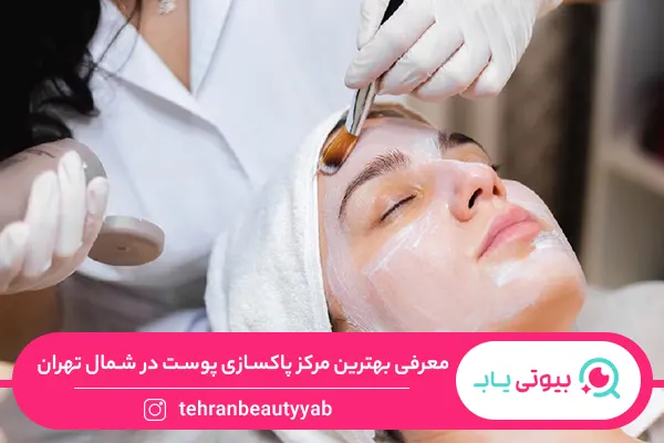 پاکسازی و فیشیال در شمال تهران