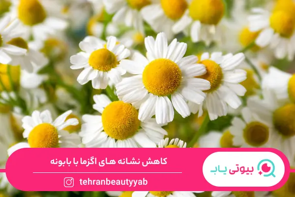 خواص بابونه برای پوست