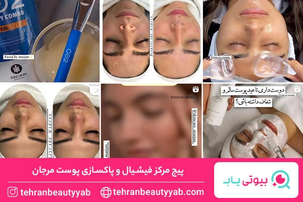 پاکسازی پوست تهرانپارس