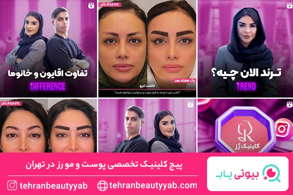 بهترین مرکز کاشت مژه در تهران