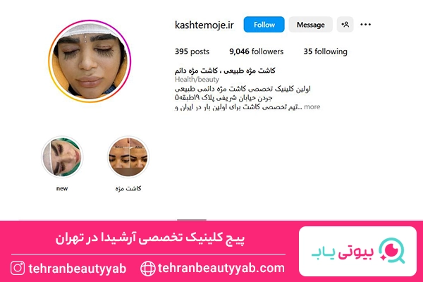 بهترین مرکز کاشت مژه در تهران