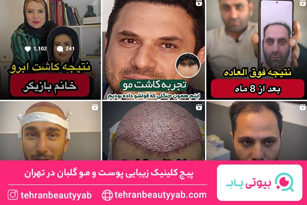 بهترین کلینیک زیبایی در تهران