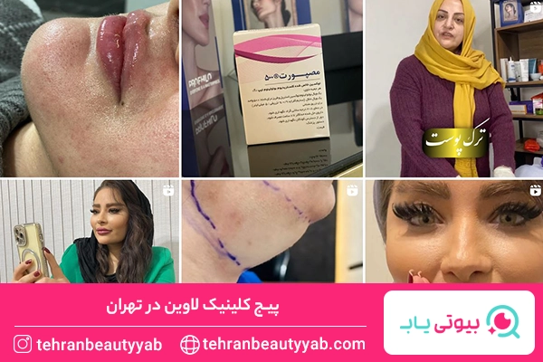 بهترین کلینیک زیبایی در تهران