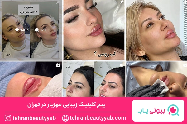 بهترین کلینیک زیبایی در تهران