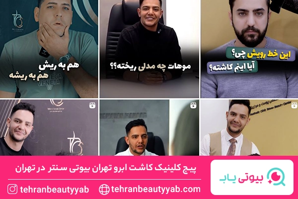 بهترین کلینیک کاشت ابرو در تهران